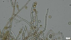 Botryobasidium