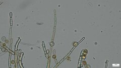 Botryobasidium