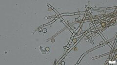 Botryobasidium