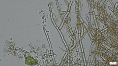 Botryobasidium