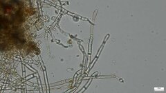 Botryobasidium