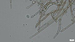 Botryobasidium