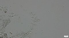 Akanthomyces