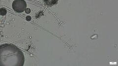 Akanthomyces