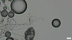Akanthomyces