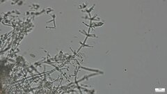 Akanthomyces