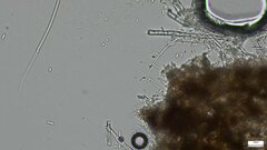 Akanthomyces