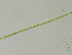 Dolichospermum