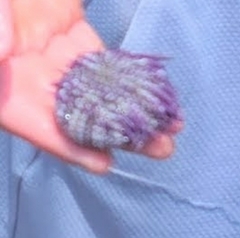 Strongylocentrotus purpuratus