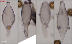 Strobilomyces strobilaceus