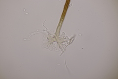 Podosphaera myrtillina