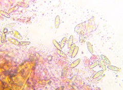 Buchwaldoboletus lignicola