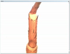 Dysdera