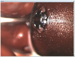 Dysdera