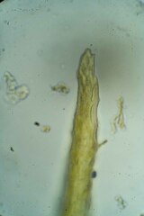 Dicranum acutifolium