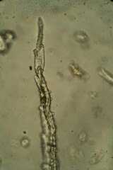 Racomitrium canescens latifolium