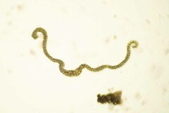 Racomitrium canescens latifolium