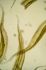 Racomitrium canescens latifolium