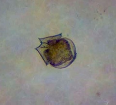 Protoperidinium