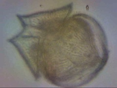 Protoperidinium