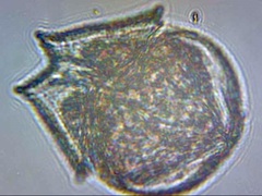Protoperidinium