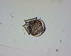 Protoperidinium