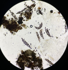 Delitschia polyspora