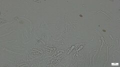 Boletaceae