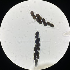 Delitschia chodocola