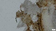 Lanmaoa angustispora