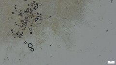 Lanmaoa angustispora