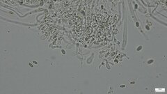 Lanmaoa angustispora