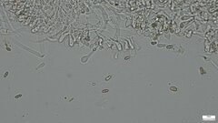 Lanmaoa angustispora