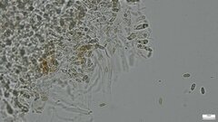 Lanmaoa angustispora