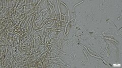 Lanmaoa angustispora