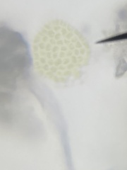 Pseudopediastrum