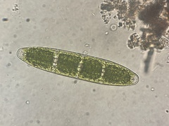 Planotaenium interruptum