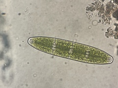 Planotaenium interruptum