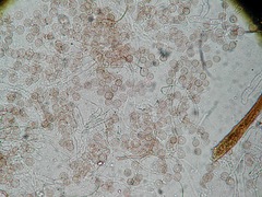 Clastoderma debaryanum