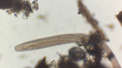 Spirostomum
