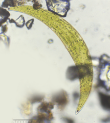 Closterium lunula