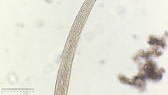Spirostomum