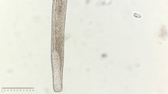 Spirostomum