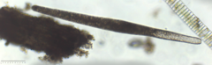 Spirostomum