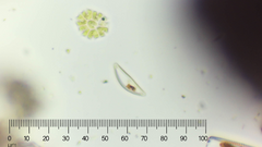 Cymbella