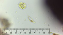 Cymbella