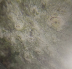 Pertusaria leioplaca