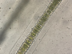 Hyalotheca