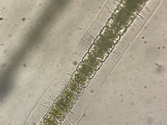Hyalotheca