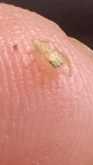 Salticidae